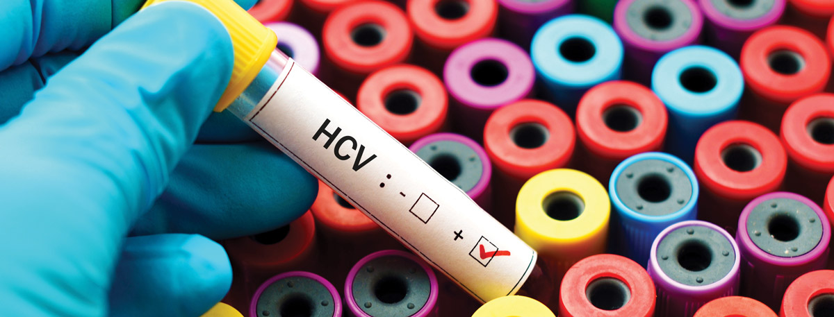 Princeton House Behavioral Health Is Pioneering Hepatitis C Research and Care Access